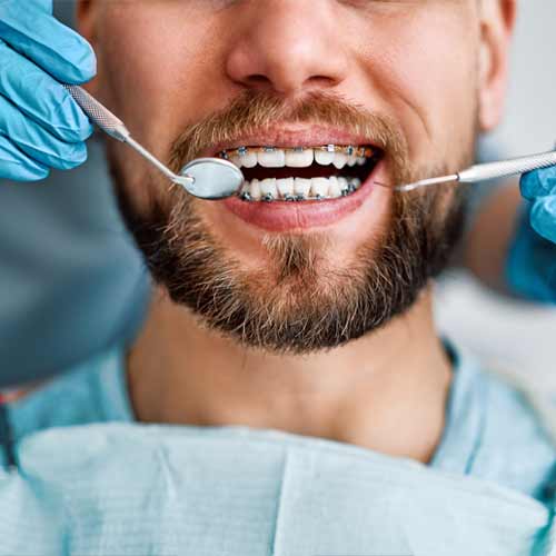 Man getting dental work done